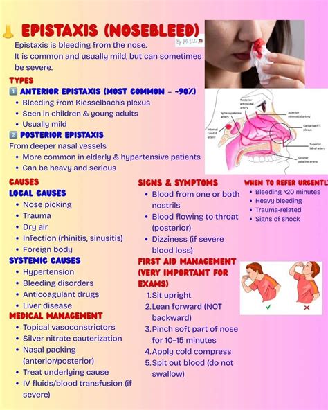 Understanding Epistaxis Causes and First Aid | Dr. Fahry faisal posted on the topic | LinkedIn
