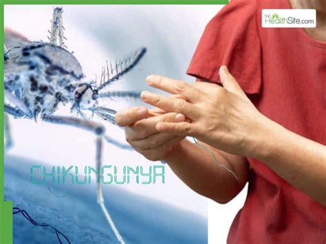 Chikungunya outbreak alert 2026: Travel ban imposed as deadly virus ...