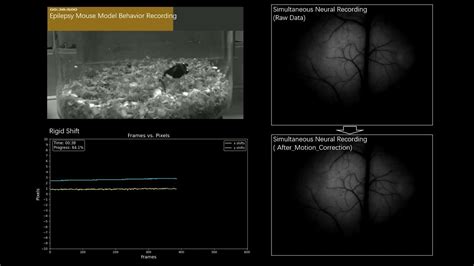 The Optically Guided and Pre-assembled Implantation Cranial Window ...