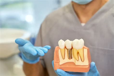 Types of Dental Implants: Choosing the Right Option for You • Hulme ...