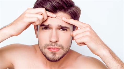 Does Caffeine Cause Acne? Real Experiences | TheBeautyFoodie