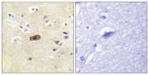 Anti-NMDAR2A antibody produced in rabbit - GRIN2A, Glutamate [NMDA ...