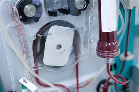 CRRT Machine Explained: Lifesaving Technology for Critical Care