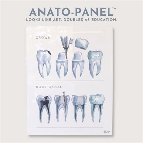 Lyon Road Art Crown & Root Canal Dental Diagram - Shop