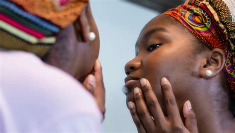 Riscos de espremer espinha vão de cicatriz até morte: entenda - Tá Saudável