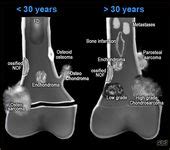 VirtualMedStudent.com || Pyogenic Liver Abscess | Radiology ...