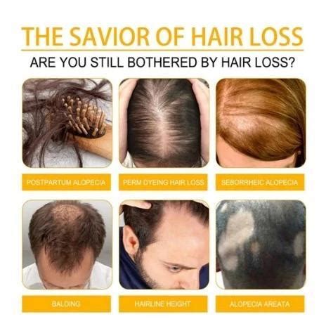 [COD - FREE ONGKIR] - Batana Oil Serum Anti Rontok Penumbuh Rambut ...