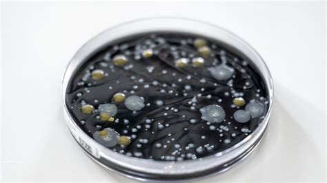 Legionella Outbreak in Basel Has Ended