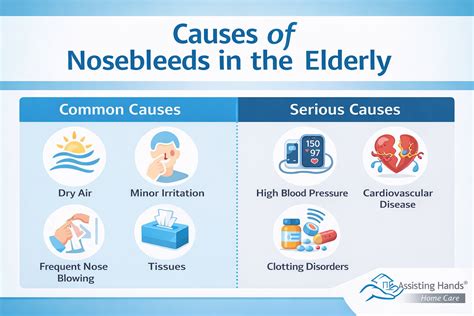 When to Worry About Nosebleeds in the Elderly | Signs & Treatment