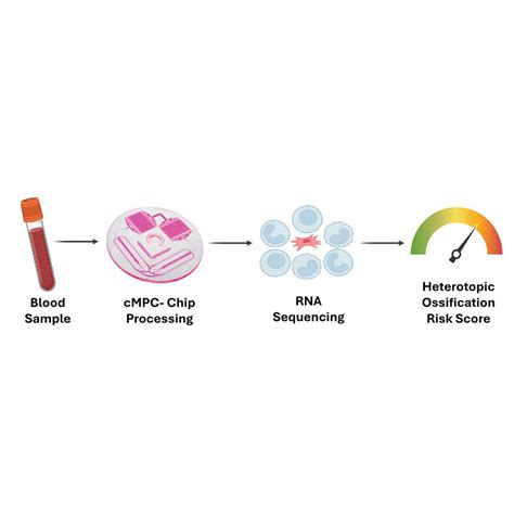 Simple blood test may predict abnormal bone growth early: Newsroom - UT ...