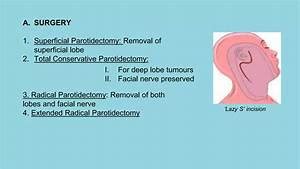 Parotid gland anatomy, surgical anatomy, disease | PPTX - MSF Resources