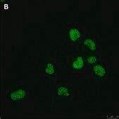 Anti-Olig2 Antibody, clone 1K2 ZooMAb® Rabbit Monoclonal recombinant ...