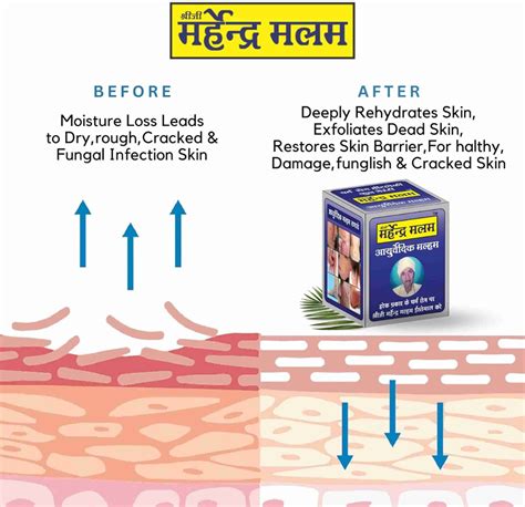 Rudramani Sheeji Mahendra Authentic Ayurvedic Anti-Fungal Malam ...