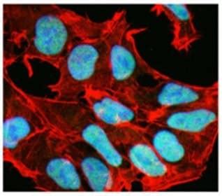 Recombinant Antibody Technology