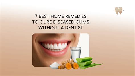 How to Cure Gum Disease Without a Dentist ⋆ ctf.bnsf.com