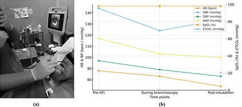 Awake tracheal intubation for follicular ameloblastoma of the anterior ...
