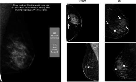 Comparing search patterns in digital breast tomosynthesis and full ...