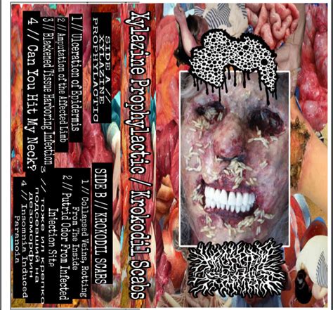 SPLIT W/ XYLAZINE PROPHYLACTIC | Krokodil Scabs