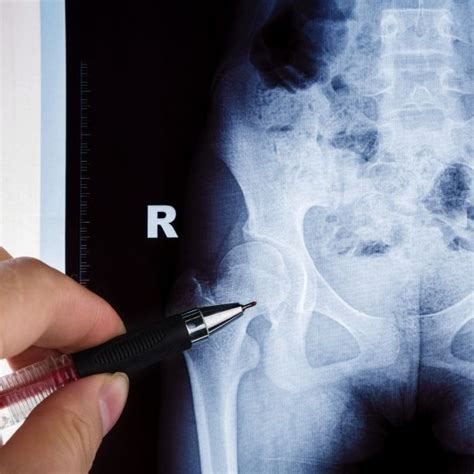️ 65 € Pelvis X-ray (four views) in Jaén