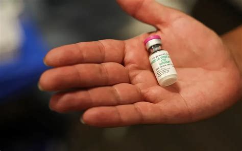 How shingles and chickenpox still shape our health