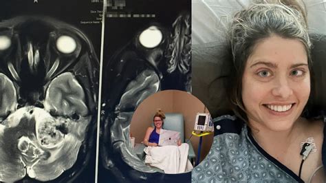 Volleyball Accident Leaves A Woman With Rare Condition Of Multiplying ...