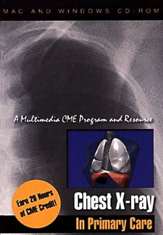 Buy Chest X-Ray Interpretation In Primary Care: A Multimedia CME ...
