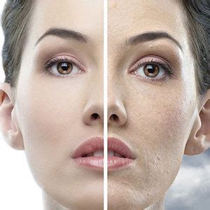 Healthgenie Imported Steam Sauna Vaporizer Machine, Facial Steamer And ...