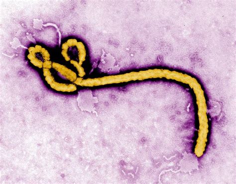 埃博拉病毒 | 中国国家地理网