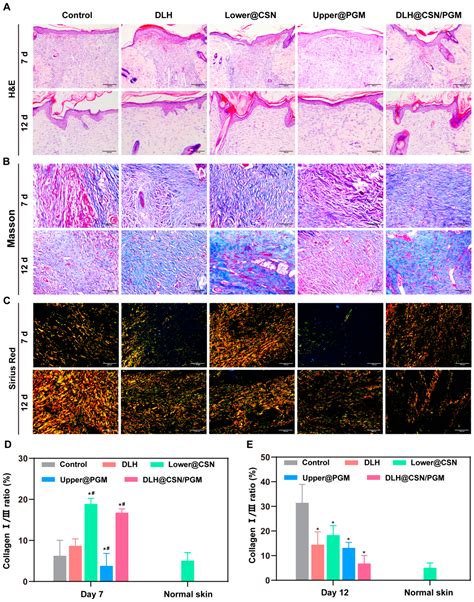 Biodegradable Double-Layer Hydrogels with Sequential Drug Release for ...