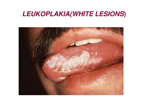 PPT - ORAL CAVITY PowerPoint Presentation, free download - ID:255788