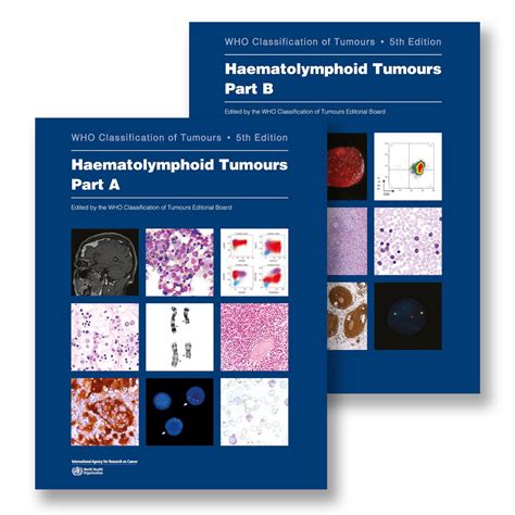Haematolymphoid Tumours: Who Classification of Tumours | Retail Maharaj