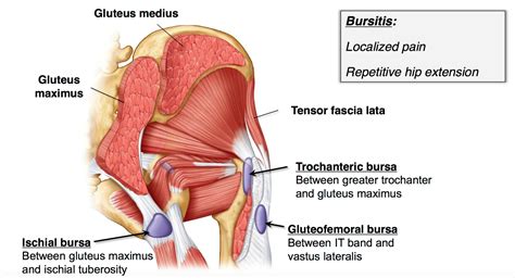 What Causes Butt Pain/Gluteal Pain? - San Diego Running & Sports Injury Clinic