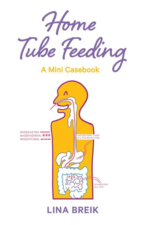 Buy Home Tube Feeding: A mini casebook Book Online at Low Prices in ...