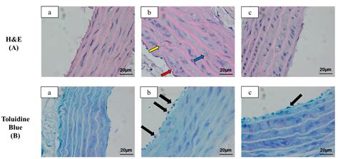 Anti-Atherogenic Effects of Orlistat on Obesity-Induced Vascular ...