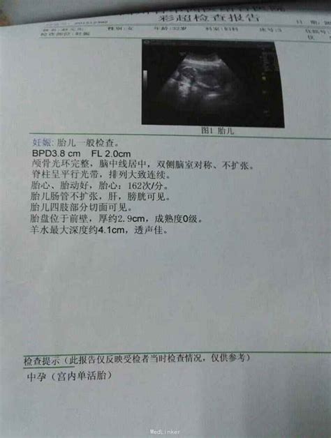 孕早期这周出血，表明小宝宝正在健康成长，孕妇不要无故担忧