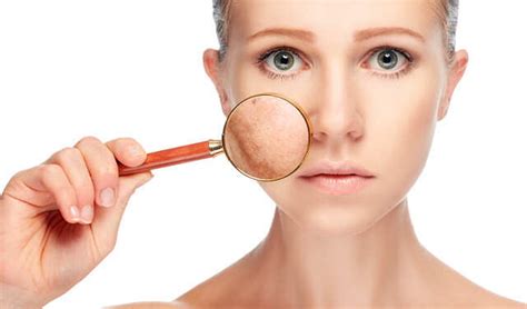The Beauty Benefits Of Beetroot For Skin | Femina.in