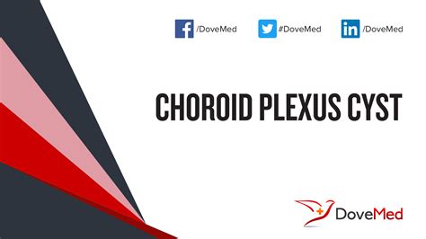 Choroid Plexus Cyst