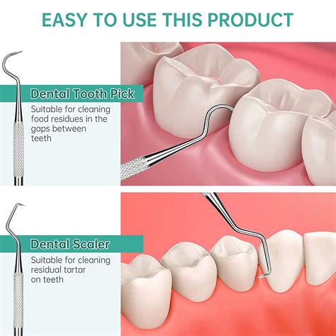 Dental Scaler And Scraper at Douglas Sexton blog
