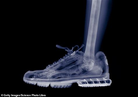 Image result for Runner Tripping