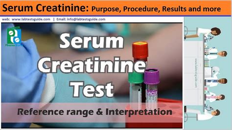 Image result for Creatinine Lab Testing