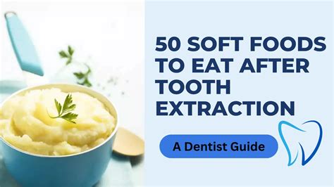 50 Soft Foods to Eat After Tooth Extraction | Dentist Guide
