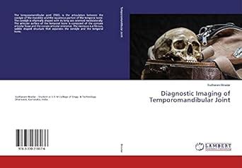 Diagnostic Imaging of Temporomandibular Joint : Sudharani Biradar ...