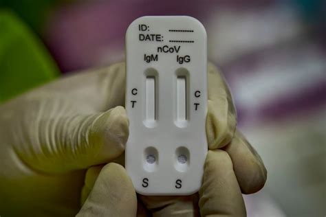 Coronavirus antibody testing is now easy to get. But it’s hard to be ...