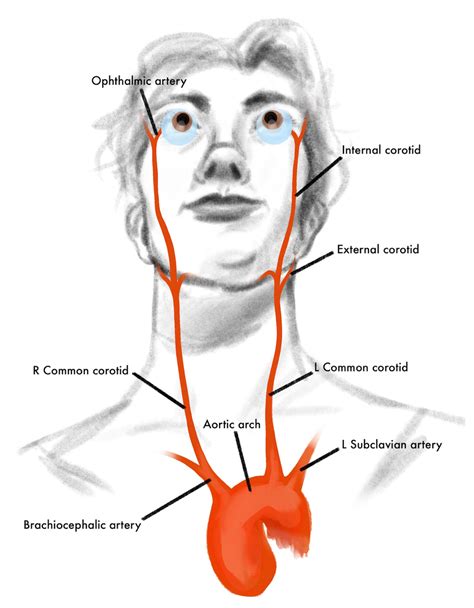 EyeRounds.org: Ocular Ischemic Syndrome