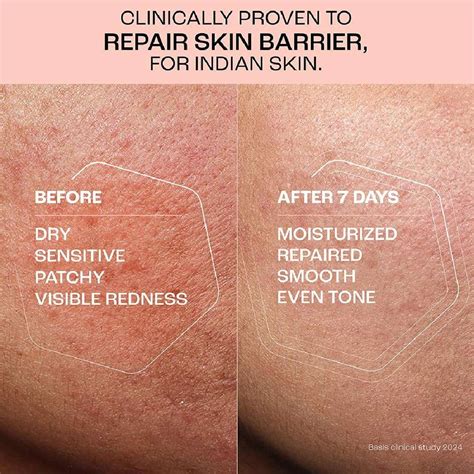 Lakmé Peach Milk Vit E Cream Moisturizer - Price in India, Buy Lakmé ...