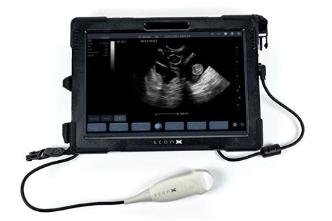 ScanX - Portable Ultrasound Machines