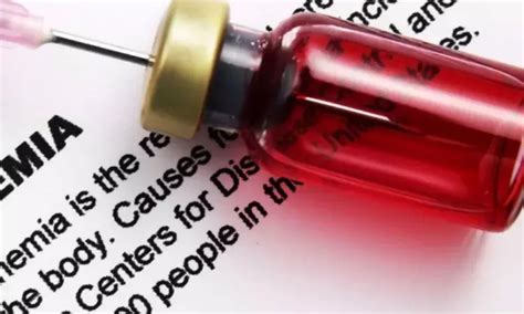 Laboratory diagnosis of iron deficiency in adults and children: BSH ...