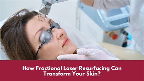 How Fractional Laser Resurfacing Can Transform Your Skin? | Canada MedLaser