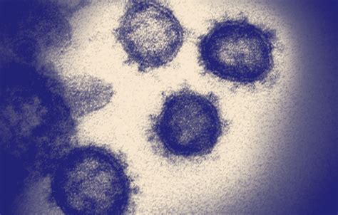 The Upward Slope of Pandemic Politics | NewsClick