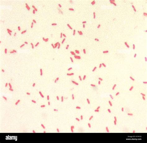 Proteus Vulgaris Gram Stain 1000x